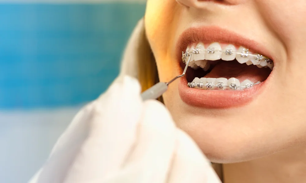 Why a Denture Specialist Matters for Your Oral Health