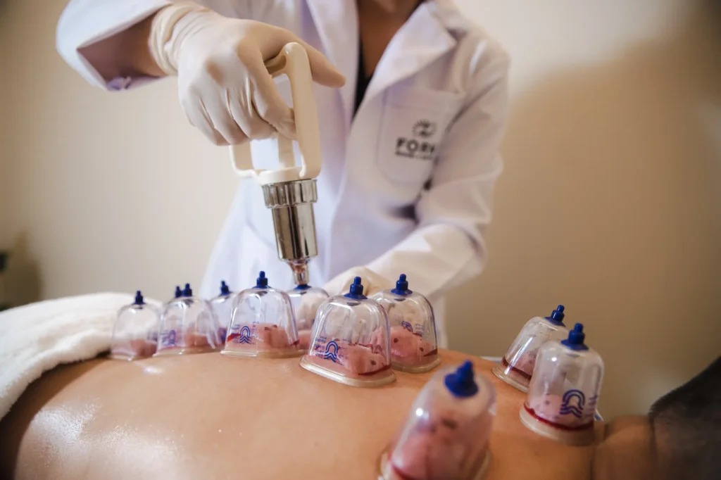Discover the Benefits of Cupping Therapy in Bangkok: A Comprehensive Guide